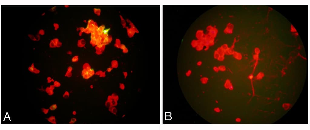 HMPV / Metapneumovirus Antibody (clone HMPV24)