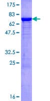 Human SERPINA1 / Alpha 1 Antitrypsin Protein (Recombinant GST)