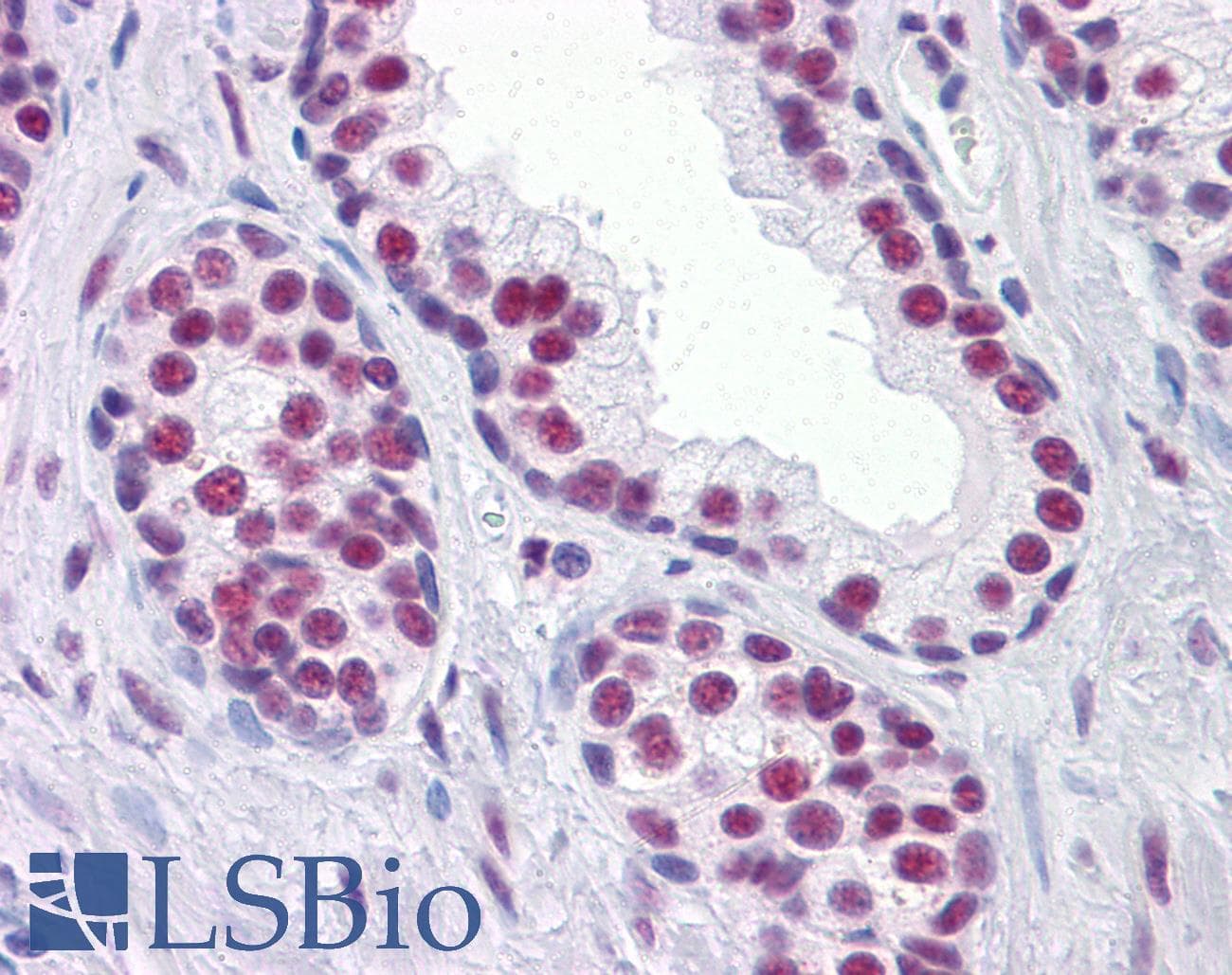 IHC-plus™ CBFA1 / RUNX2 Antibody (clone 1D8)