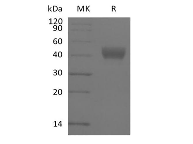 Human CD38 Protein (Recombinant 6His-AVI, N-terminus)