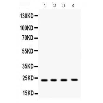 Polyclonal Rabbit anti-Human RAB7A / RAB7 Antibody (aa157-196, WB)