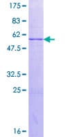 Human ACMSD Protein (Recombinant GST)