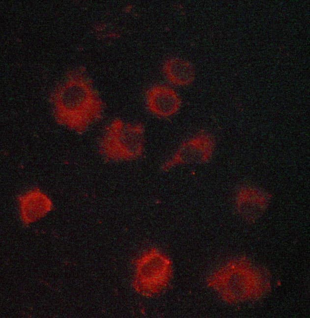Polyclonal Rabbit anti-Human NFKBIE / IKB Epsilon Antibody (IHC, IF, WB)