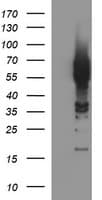 TH / Tyrosine Hydroxylase Antibody (clone OTI2E5)
