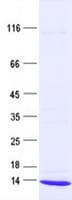 Human B2M / Beta 2 Microglobulin Protein (Recombinant DDK,C-terminus)
