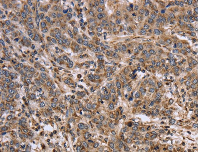 IHC-plus™ Polyclonal Rabbit anti-Human EPOR / EPO Receptor Antibody (aa31-79, IHC)