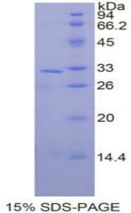 Human MAPK9 / JNK2 Protein (Recombinant His-T7)