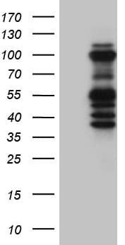 ASH2L / ASH2 Antibody (aa347-628, clone OTI2H3)