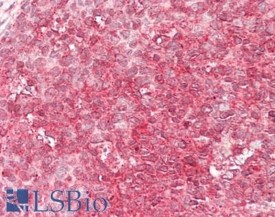 CAPN1 / Calpain 1 Antibody (aa75-343)