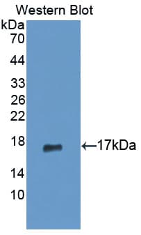 PIP / GCDFP-15 Antibody (aa41-139)