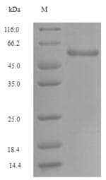 Human GLS / Glutaminase Protein (Recombinant GST, N-terminus)