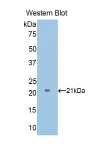 TPT1 / TCTP Antibody (aa1-172, APC)