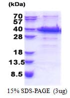 Human IGFBP7 / TAF Protein (Recombinant His)