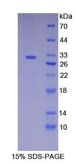 Human NCSTN / Nicastrin Protein (Recombinant His-T7)
