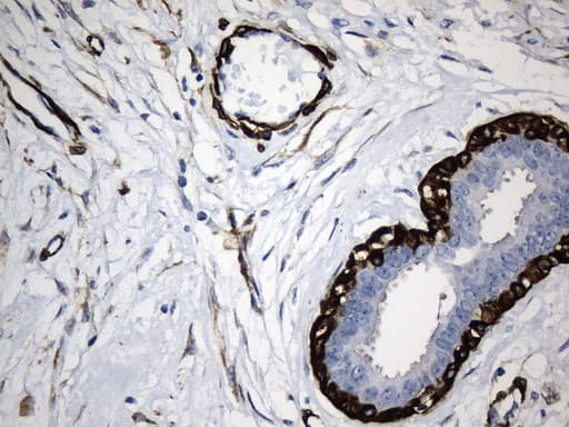 ACTA2 / Smooth Muscle Actin Antibody (N-Terminus, clone UMAB237)