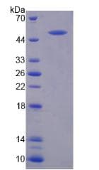 Dog VWF / Von Willebrand Factor Protein (Recombinant His-GST)