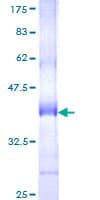 Human USP32 Protein (Recombinant GST, N-terminus)