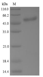 Human TP53 / p53 Protein (Recombinant 6His, N-terminus)