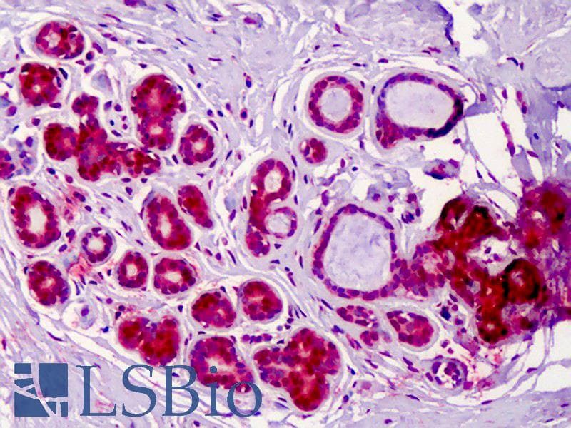 IHC-plus™ RREB1 Antibody (aa560-609)
