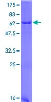 Human HAO1 Protein (Recombinant GST)