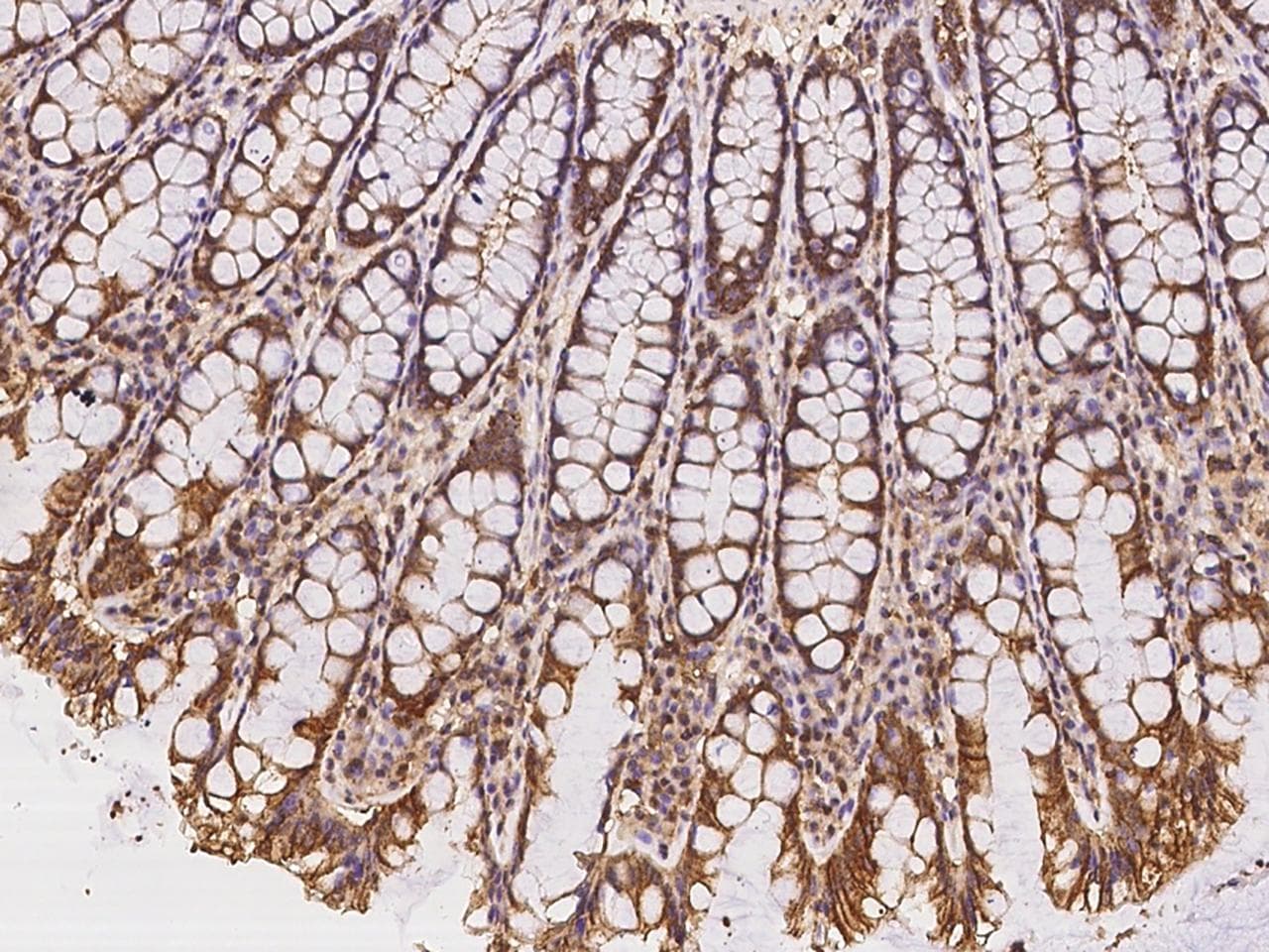Polyclonal Rabbit anti-Human WDR64 Antibody (IHC)