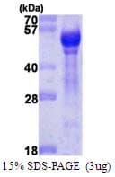Human ANGPT1 / Angiopoietin-1 Protein (Recombinant)