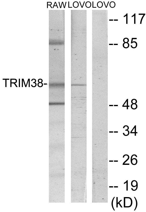 TRIM38 Antibody