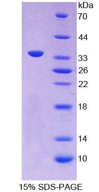 Guinea pig APOC2 / Apolipoprotein C II (Recombinant His-GST)