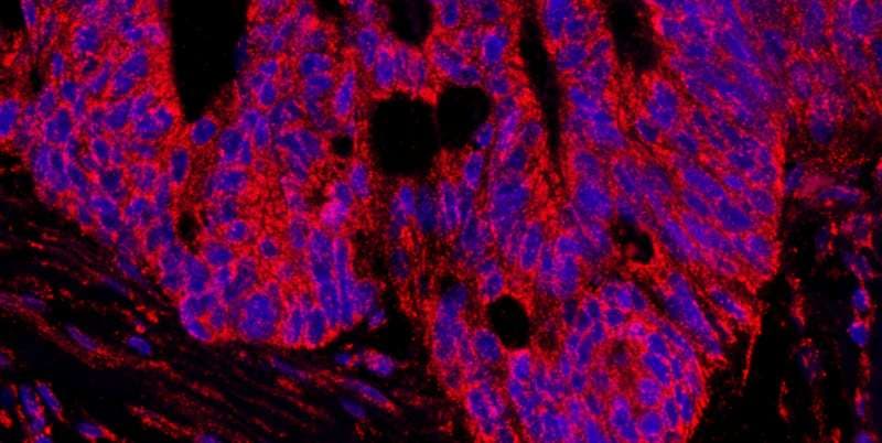 Polyclonal Rabbit anti-Human AKAP1 / AKAP Antibody (aa375-425, IHC, WB)