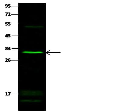 Polyclonal Rabbit anti-Human SULT1E1 / Sulfotransferase 1E1 Antibody (Preservative Free, WB)