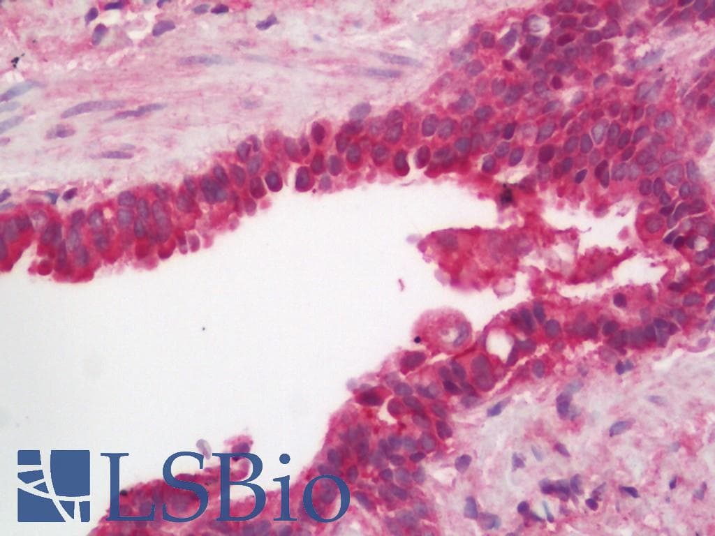 CAPN2 / Calpain 2 / M-Calpain Antibody (Biotin)