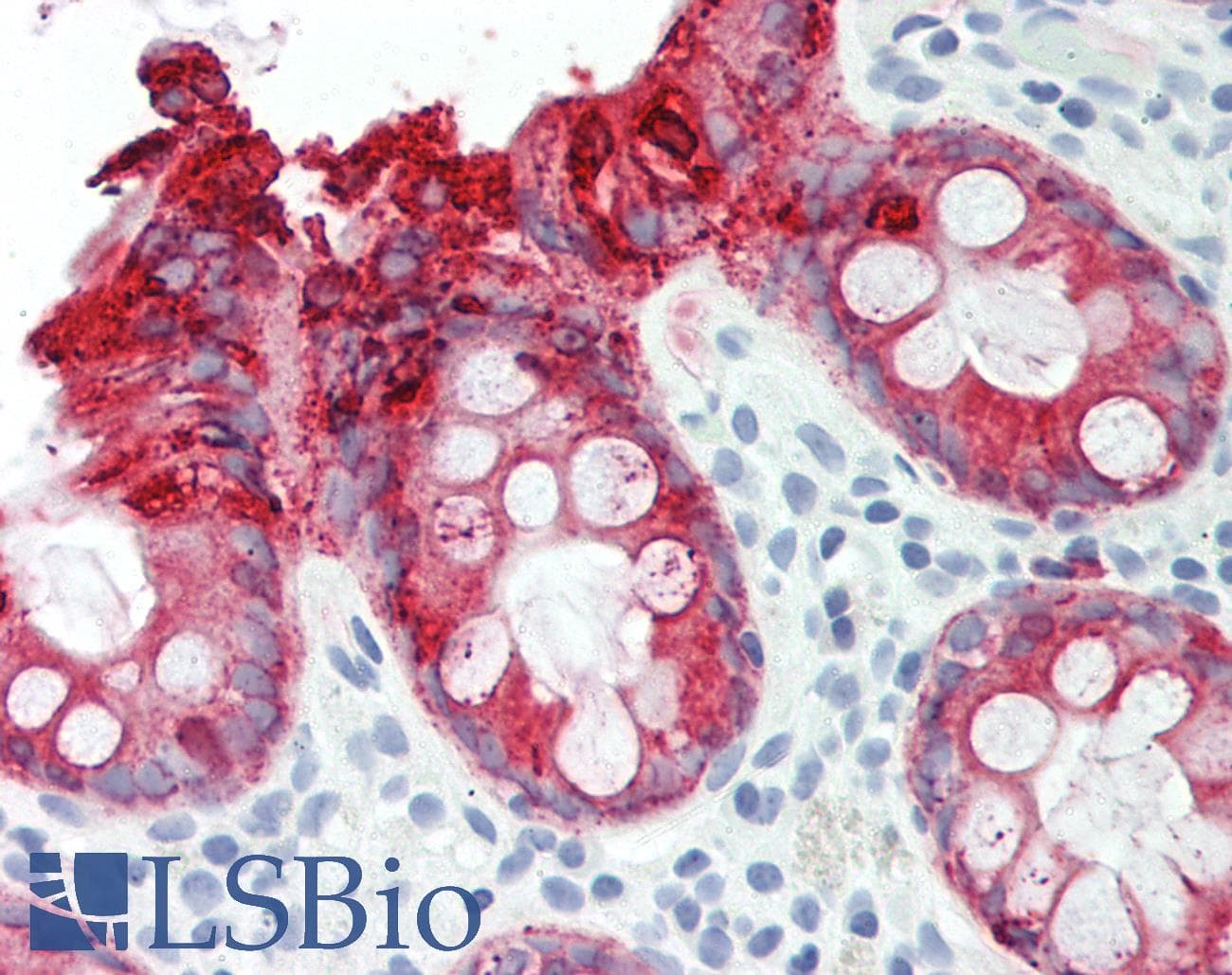 PathPlus™ Monoclonal Mouse anti-Human AGR2 Antibody (aa21-175, IHC, WB)