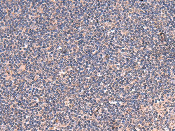 GALK2 Antibody