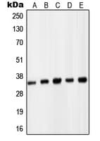 Polyclonal Rabbit anti-Human PCNA Antibody (Internal, IHC, WB)