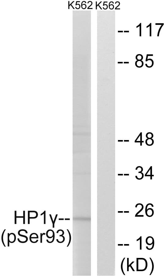 CBX3 / HP1 Gamma Antibody (phospho-Ser93)