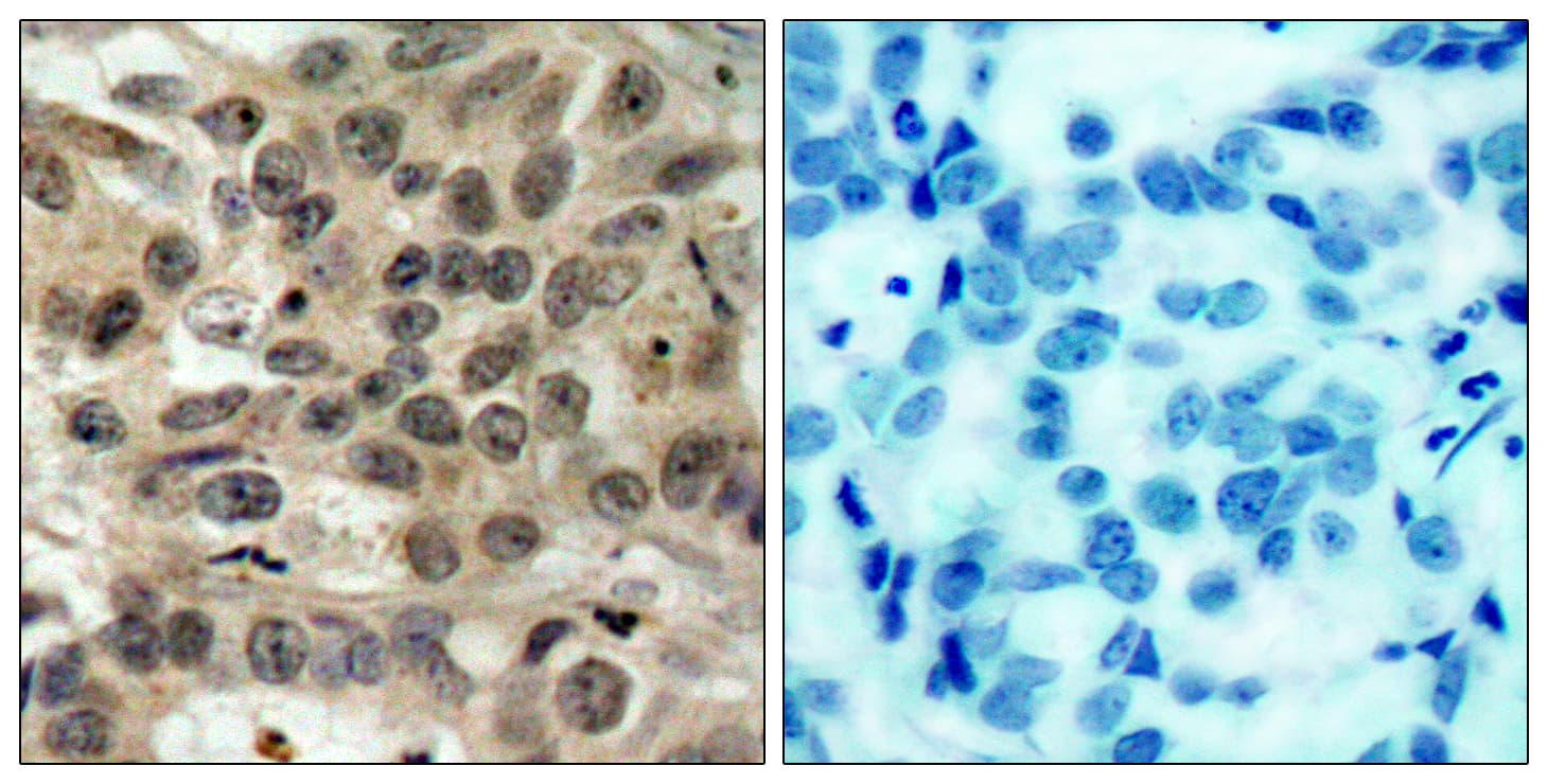 Polyclonal Rabbit anti-Human CDC25C Antibody (aa183-232, IHC, WB)