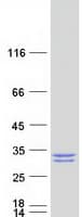 Human THEM5 Protein (Recombinant Myc-DDK (Flag))