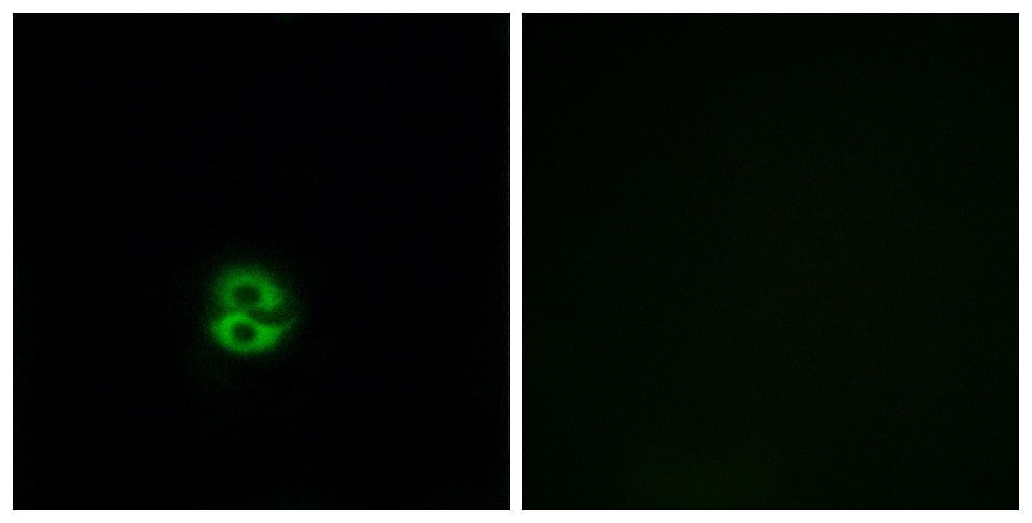 Polyclonal Rabbit anti-Human CHST6 Antibody (IF)