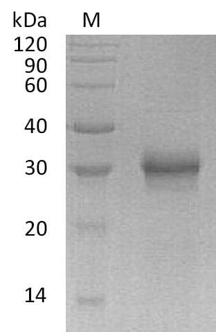 Human FGF17 Protein (Recombinant 6His, C-terminus)