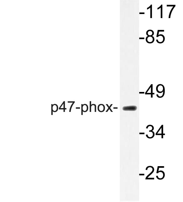 NCF1 / p47phox / p47 phox Antibody (Pro300)