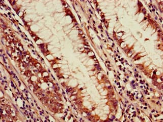 PDS5A Antibody