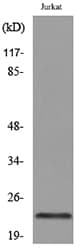 Polyclonal Rabbit anti-Human IFNE / Interferon Epsilon Antibody (WB)