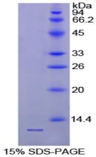 Chicken PTH / Parathyroid Hormone Protein (Recombinant His)