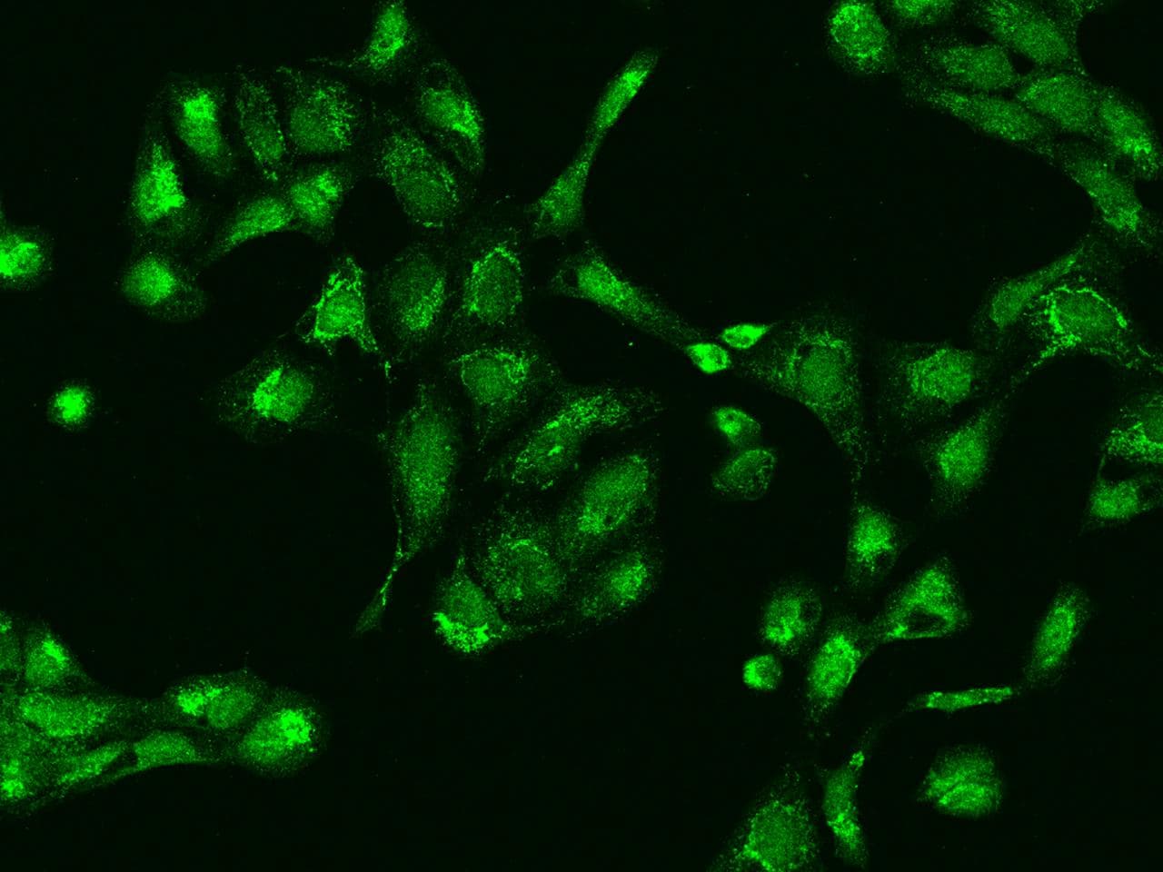 TRMT10C / RG9MTD1 Antibody