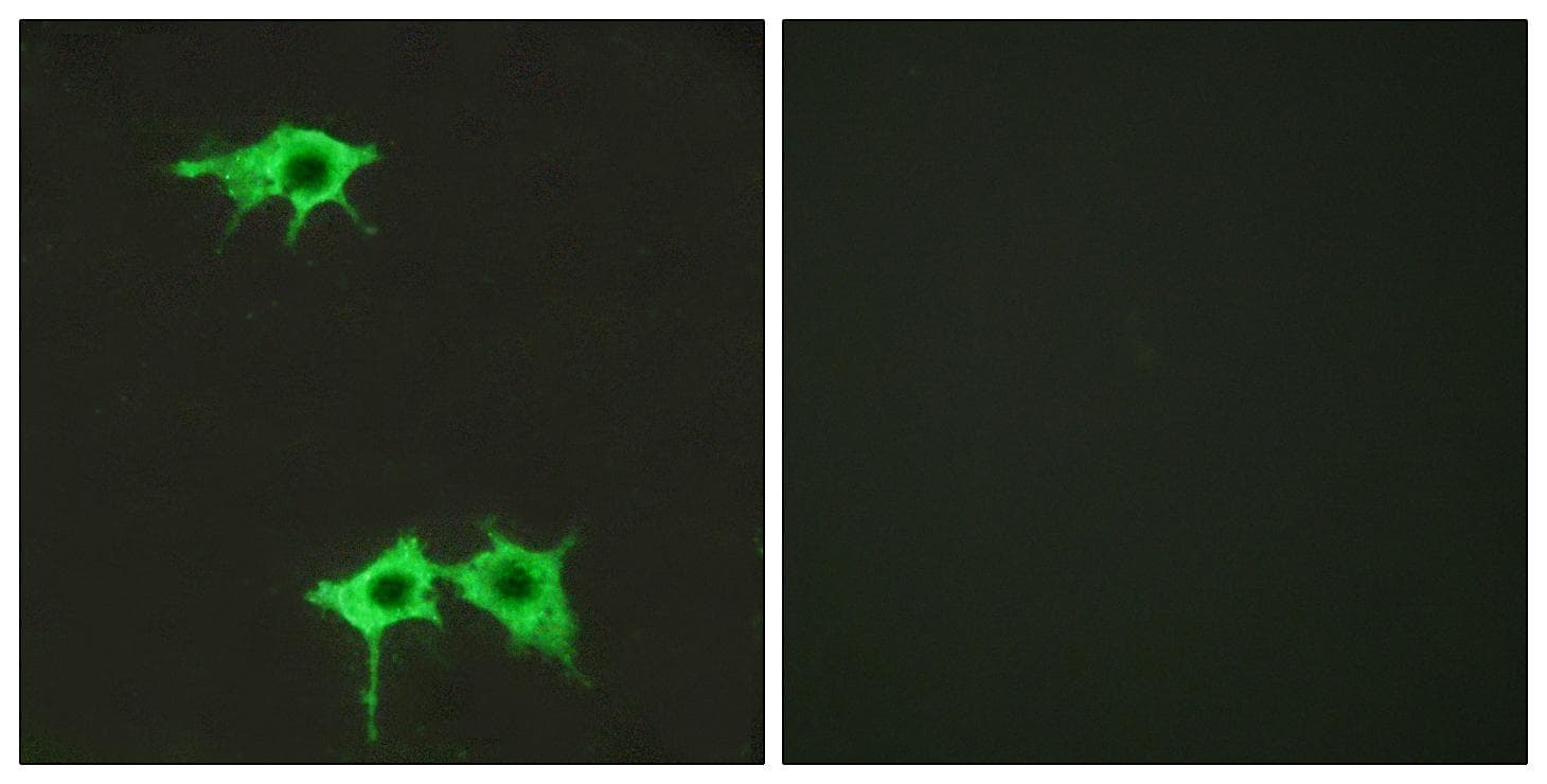 FZD4 / Frizzled 4 Antibody