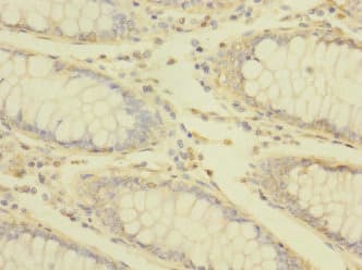 TRPM7 Antibody