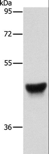 KRT13 / CK13 / Cytokeratin 13 Antibody