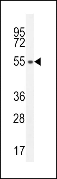 SLC35E2 Antibody (aa1-30)
