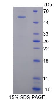 Mouse OSMR / IL-31R-Beta Protein (Recombinant His-GST-S)