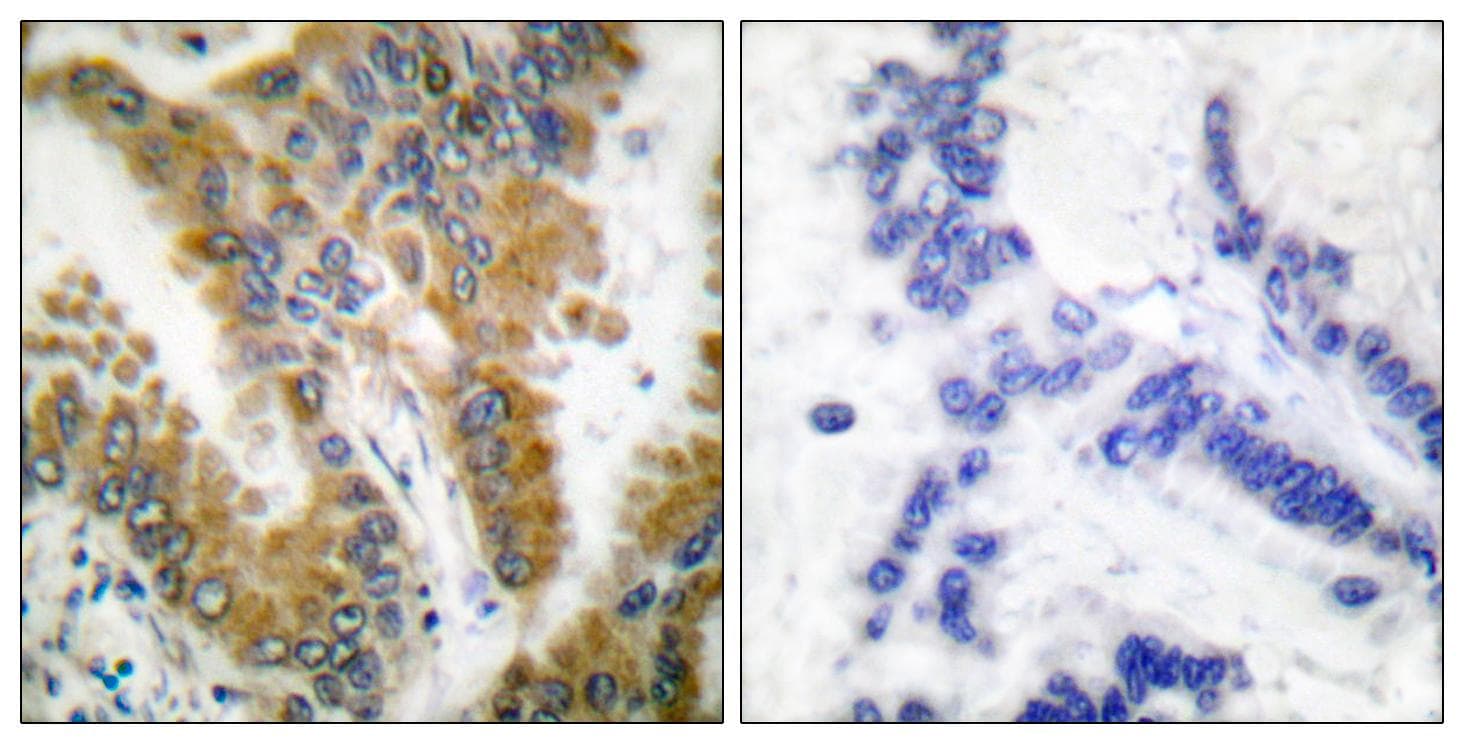 CRKL Antibody (p207)